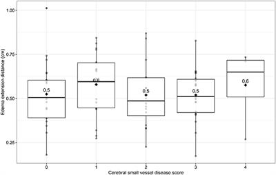 Cerebral small vessel disease and perihematomal edema formation in spontaneous intracerebral hemorrhage